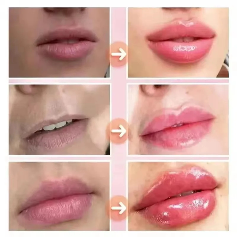 Instant Lip Plumping Essential - Lip Gloss Plumping のレビューと価格