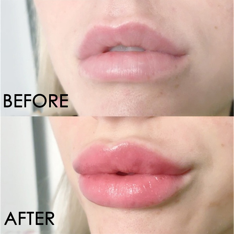 Lip Care Serum Instant Volumis - Lip Gloss Plumping のレビューと価格